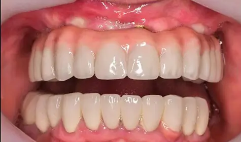 Smile Image