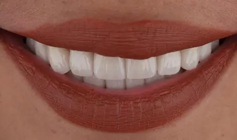 Smile Image