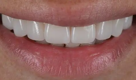 Smile Image
