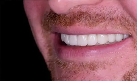 Smile Image