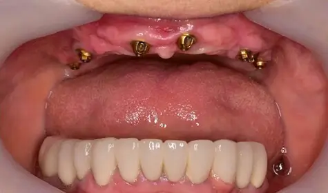 Smile Image