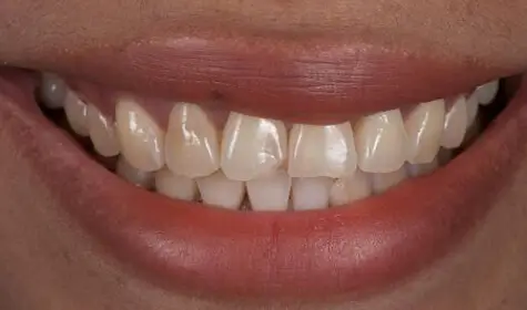 Smile Image