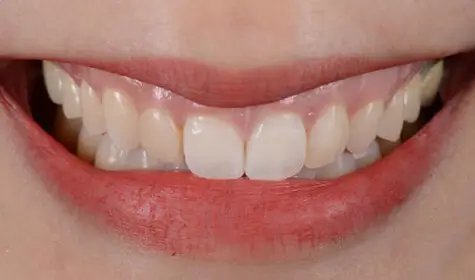 Smile Image