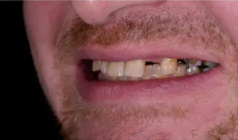 Smile Image