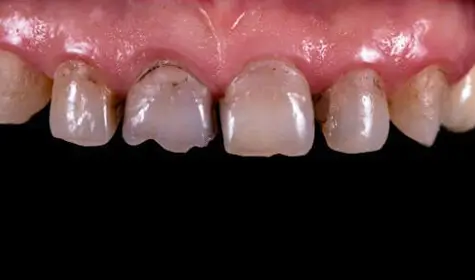 Smile Image